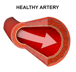Healthy Artery
